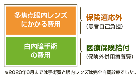 多焦点眼内レンズが選定療養