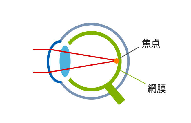 正常な目の見え方